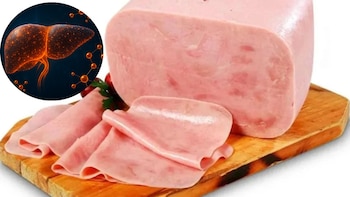 Cuáles son los efectos secundarios de comer jamón horneado de pavo y cerdo en personas con hígado graso