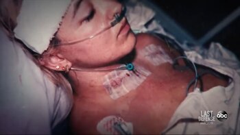 Darlie con las heridas que