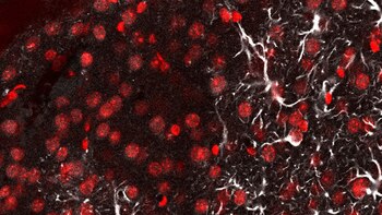 Neuronas (rojo) y astrocitos (blanco)