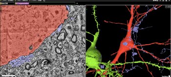 Mapa cerebral Google Harvard