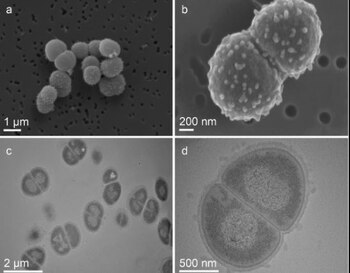 19/11/2020 Im�genes de microscop�a electr�nica