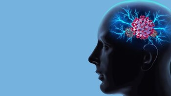 La pandemia de covid-19 generó