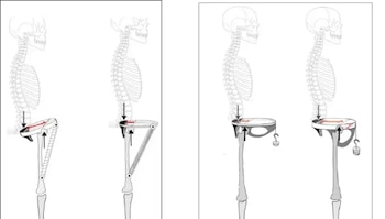 Pelvis neandertal