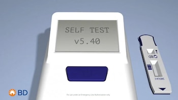 En Estados Unidos este test