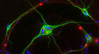 Imagen microscópica de neuronas teñidas de verde con núcleos azules y filamentos rojos, sobre un fondo oscuro, mostrando su estructura.