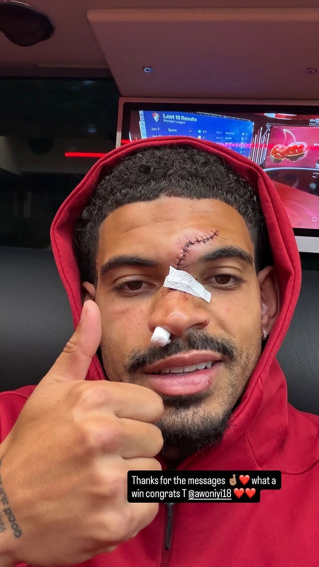 La historia que subió Morgan Gibbs-White con la impactante cicatriz en su frente
