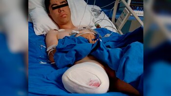 NIÑO - HERIDO - MEXICO - 07042021