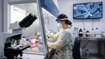 Estudio de la Nacional plantea estrategia para evitar hasta 66.000 casos de tuberculosis en personas con VIH