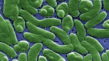 Investigadora asegura que el riesgo de infección grave por la 'bacteria carnívora' es "bajo" en población general