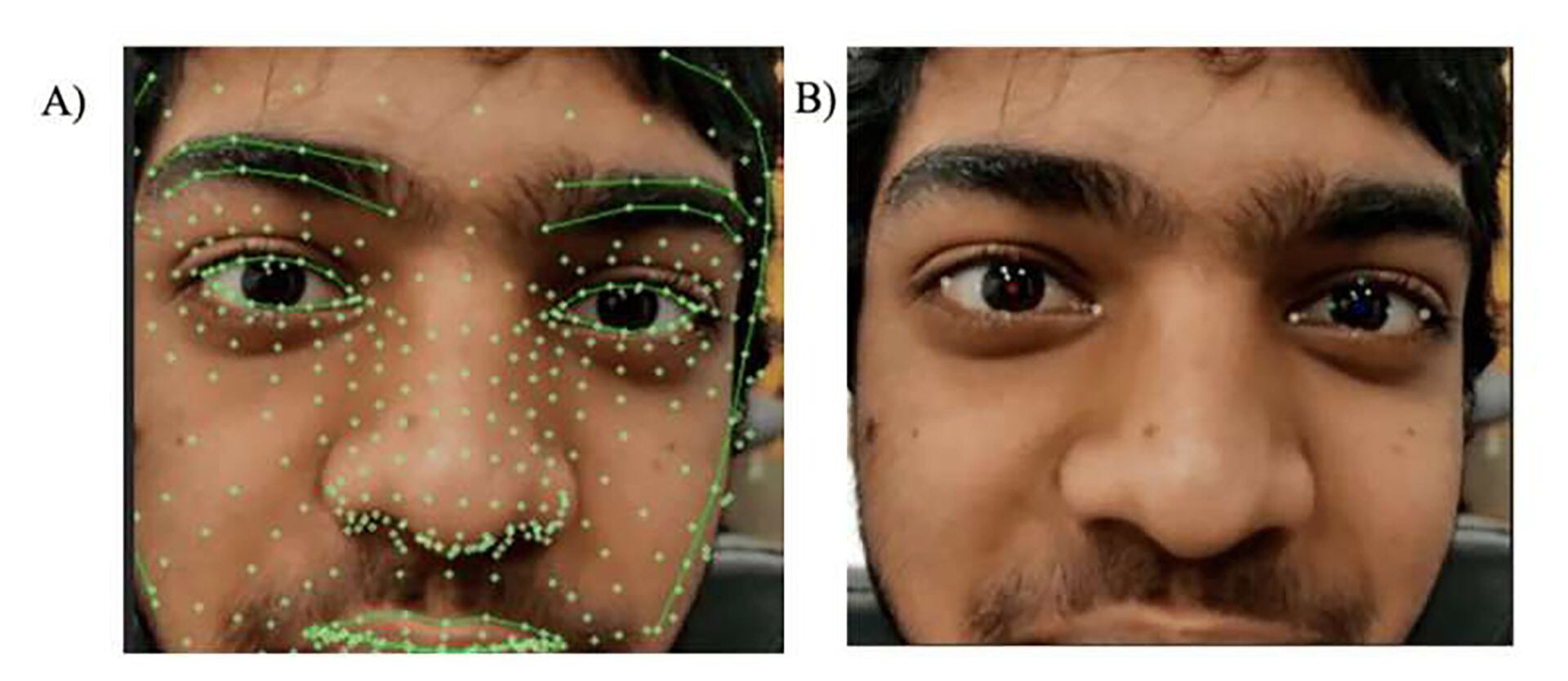 La plataforma procesa datos de 468 puntos faciales por imagen para evaluar con precisión el movimiento ocular (Créditos: Florida Atlantic University)