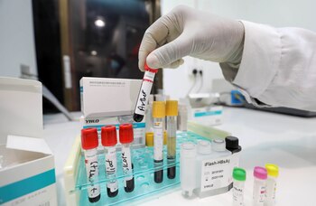 La disección espontánea de la