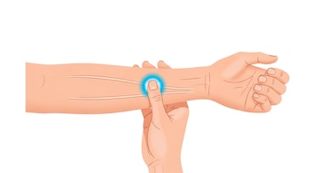 Un antebrazo con la palma hacia arriba, una mano sujeta la muñeca y un pulgar presiona un punto brillante entre dos tendones.