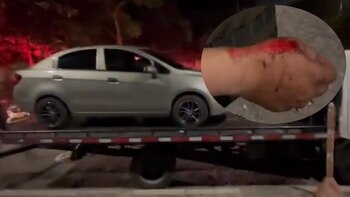 Militar borracho arrolló a dos