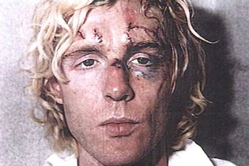 La cara de Michael Abram