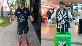 Le amputaron una pierna, vendió