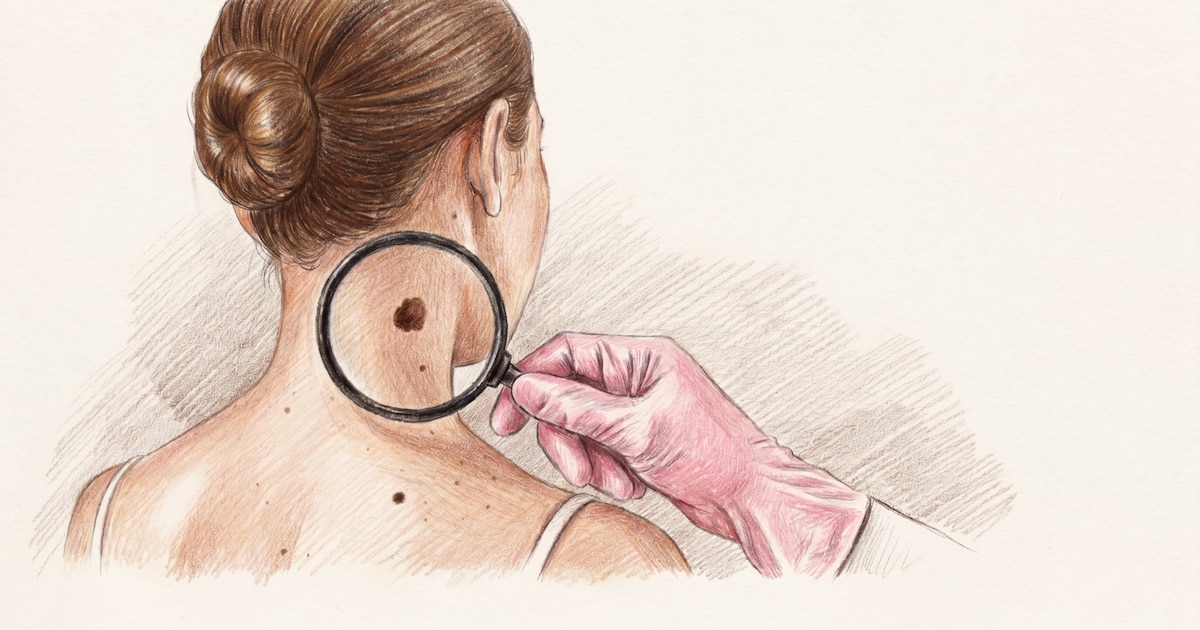 Health News: Cancer Trends, Rare Disease Research, and Access Challenges