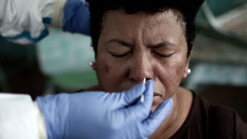 Ya hay 12 pruebas serológicas