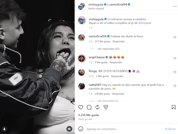 Camilota reaccionó al posteo con humor, pero contó que el reto le dejó una consecuencia física: “Todavía me duele la boca”