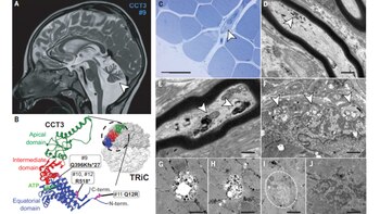 Imágenes presentadas en el artículo