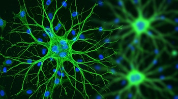 Vista microscópica de tejido cerebral oscuro. Un astrocito grande, verde brillante y enfocado, con prolongaciones ramificadas, domina el primer plano. Núcleos azules y astrocitos difusos al fondo.