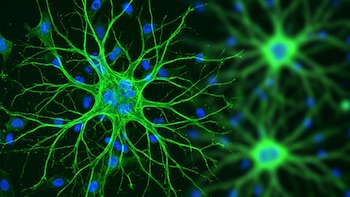 ¿Anticuerpos contra la demencia?: un experimento en ratones logró revertir el daño con dos inyecciones