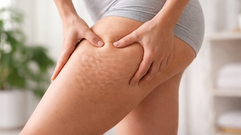 La Cleveland Clinic afirma que