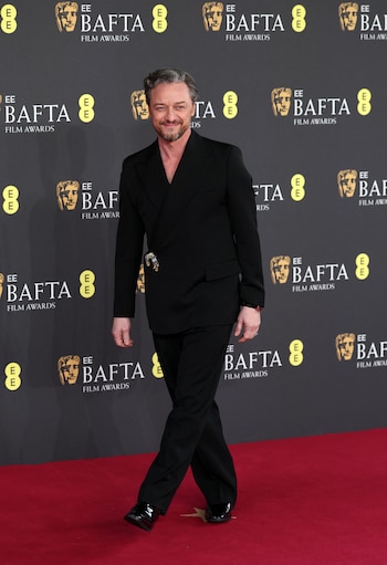 James McAvoy explicó que los médicos tuvieron que abrirlo para lavar bien por dentro. (REUTERS/Toby Melville)