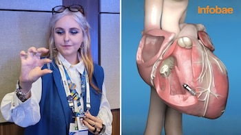 Mujer con gafas sostiene un minúsculo marcapasos cilíndrico. A la derecha, una ilustración 3D de un corazón humano con el marcapasos implantado en su interior