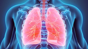 hipertensión arterial pulmonar