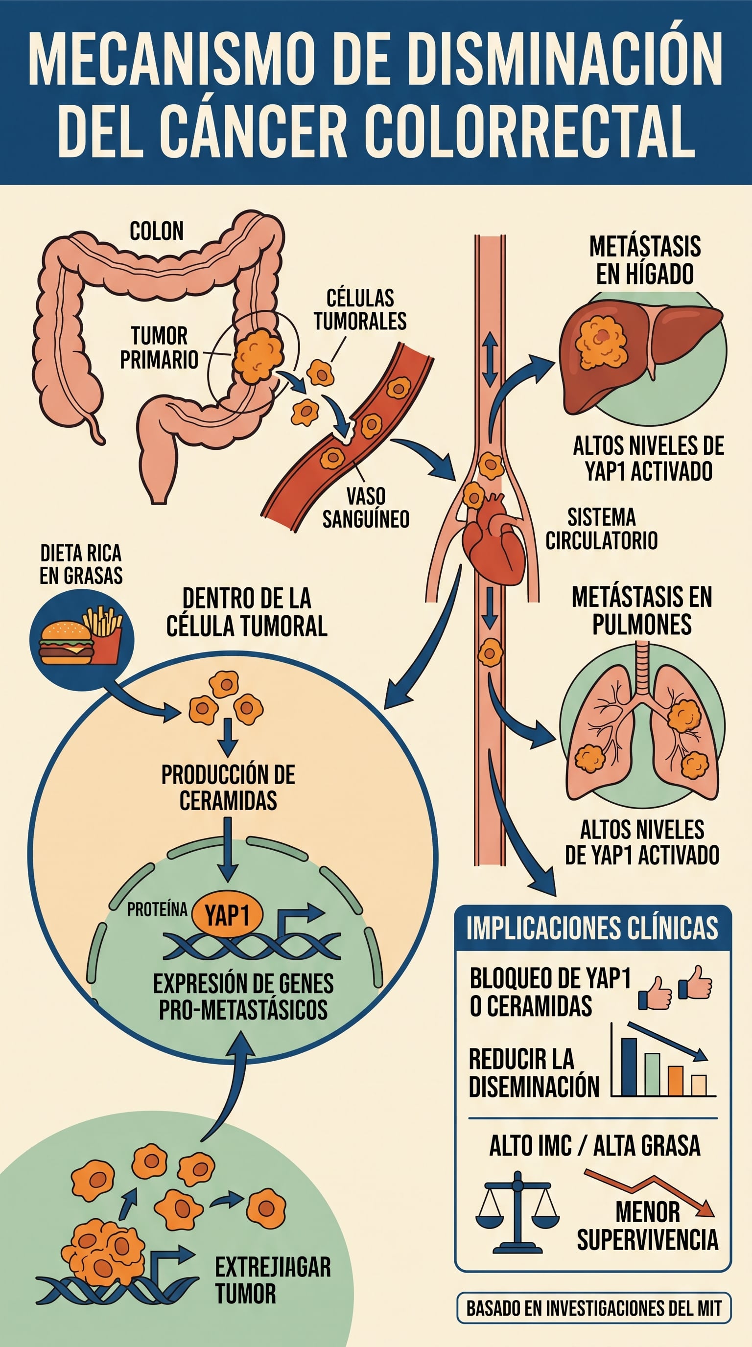 Investigaciones del Instituto Tecnológico de Massachusetts detallan la relación entre la proteína YAP1, las ceramidas y la metástasis del cáncer colorrectal hacia el hígado y los pulmones. (Imagen Ilustrativa Infobae)