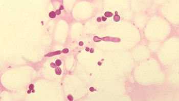 Este microorganismo habita de forma