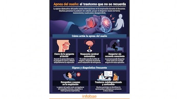 Infografía de la apnea del sueño que muestra el cierre de garganta, la respuesta cerebral, el despertar inconsciente, ronquidos y un diagnóstico médico.