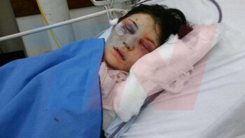 Belén Torres, la chica agredida