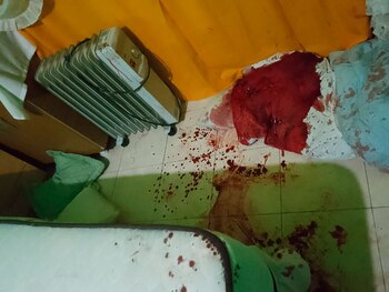 Ambos se encuentran hospitalizados