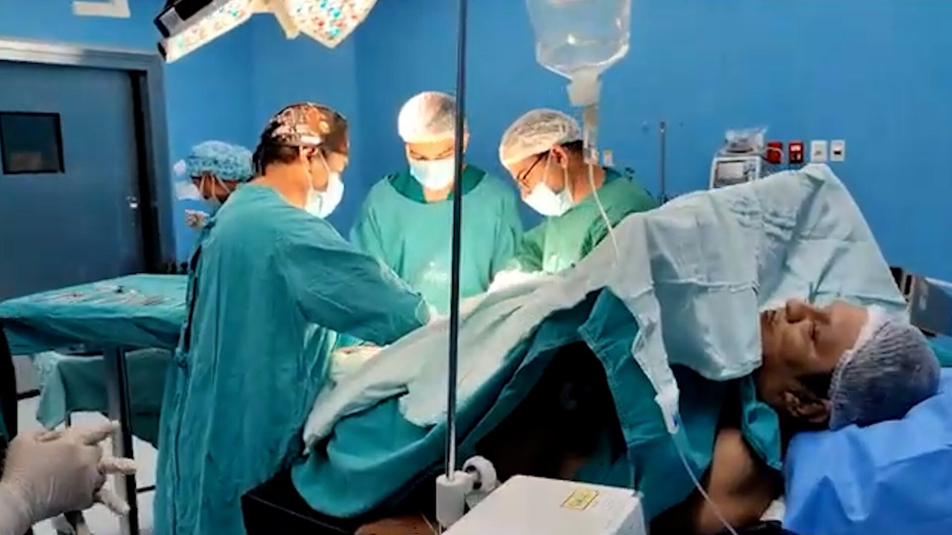 El Hospital de Tercer Nivel Montero, en Bolivia, realizó una cirugía de alta complejidad para retirar un tumor de más de 40 kilogramos del muslo derecho de James Romero (Capturar video: YouTube)