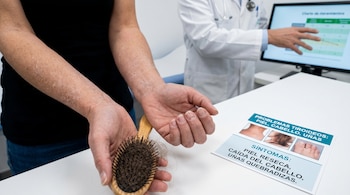 Brazos con piel seca y escamosa, manos con uñas quebradizas y un cepillo con cabello caído en primer plano. Un médico y un folleto sobre problemas de tiroides están al fondo.