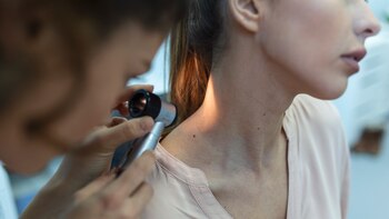 El cáncer más común que es fácil de pasar por alto: esto es lo que debemos buscar