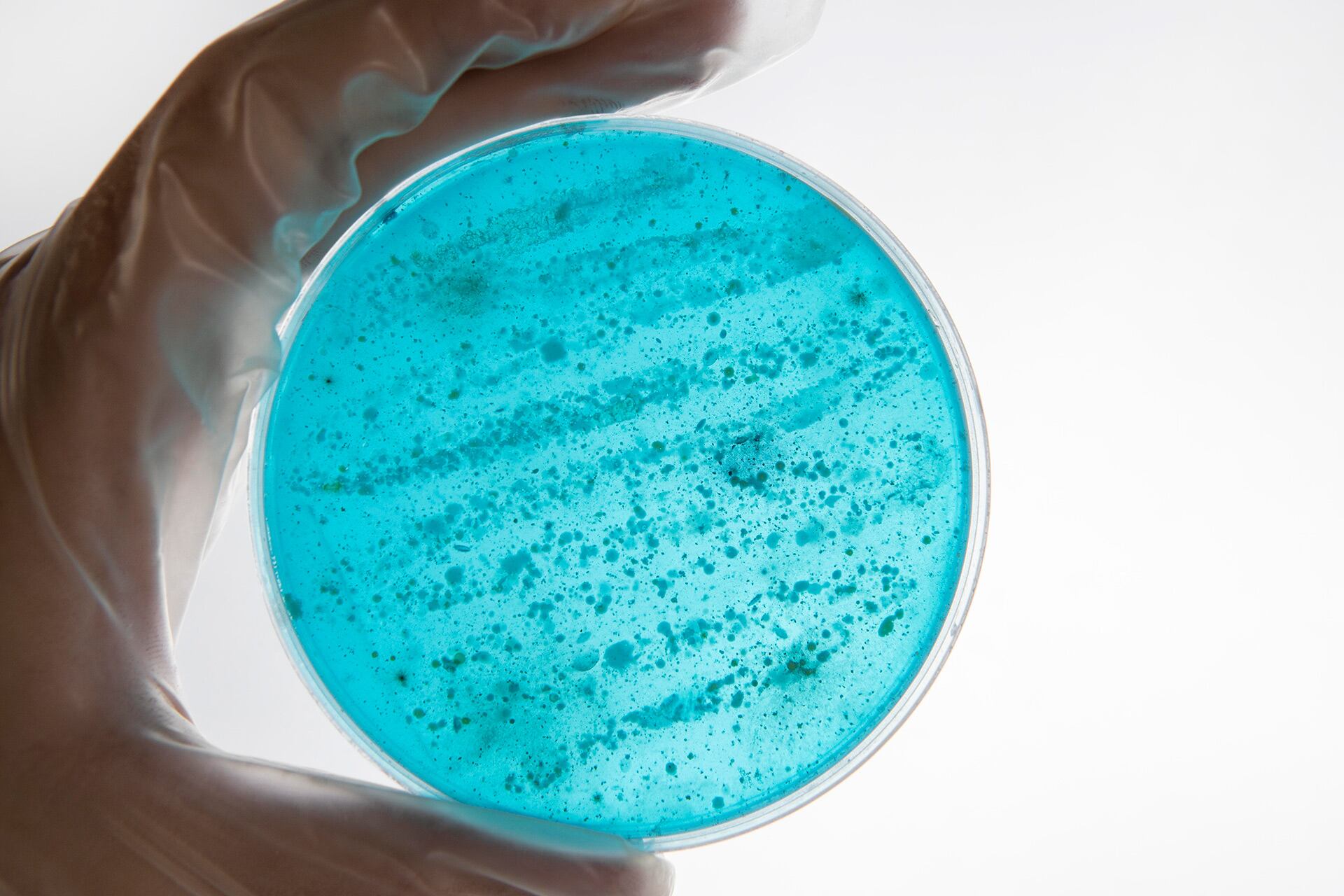Algunas proteínas que la salmonela utiliza para alterar su metabolismo también están presentes en otros patógenos bacterianos, lo que podría ampliar la comprensión de mecanismos similares en otros microorganismos (Freepik)