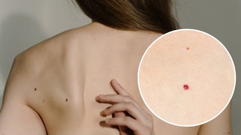 Qué significa que te salgan