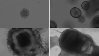 Así se observan los organoides