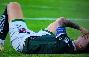 James Rodríguez quejándose de dolor