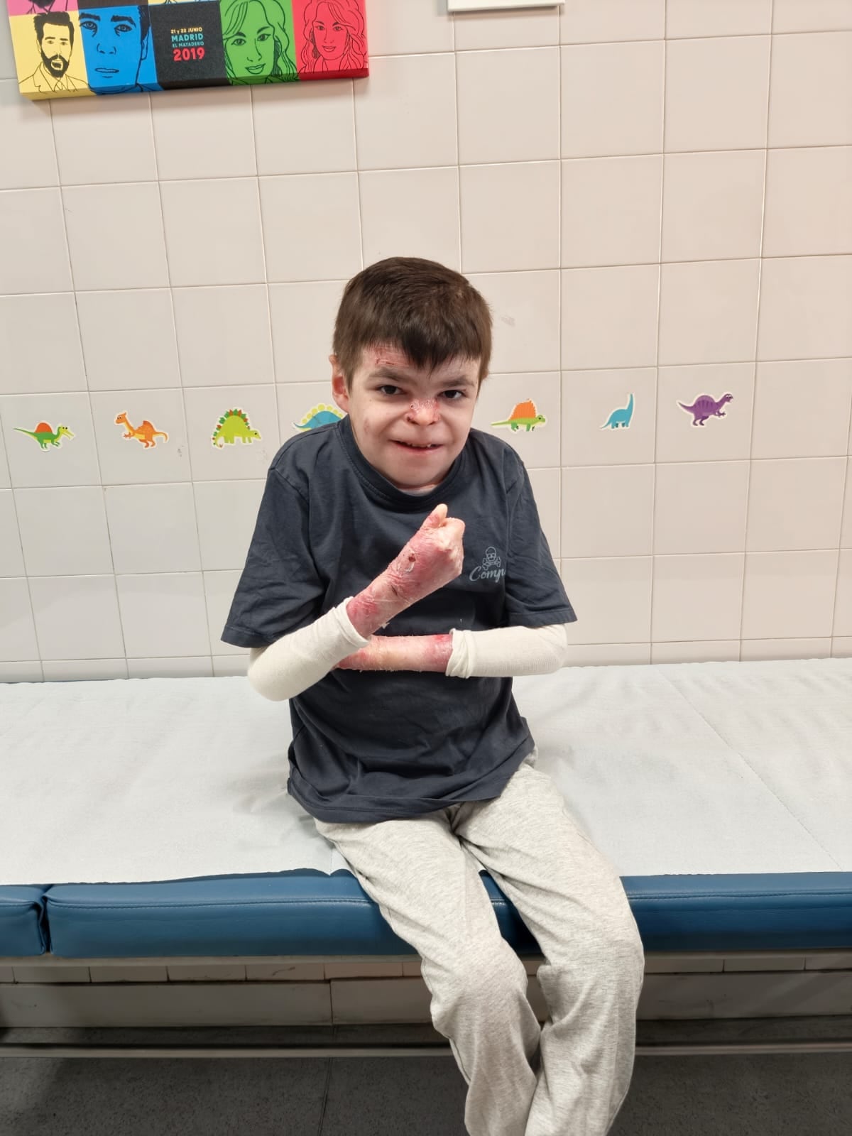 Leo, de 12 años, tras recibir la primera dosis de Vyjuvek. (@JuanMa_Moreno/X)