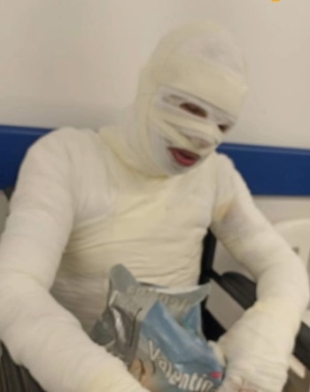 Hombre resultó con quemaduras mientras