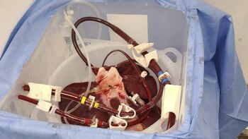 Descubrieron que el hígado de