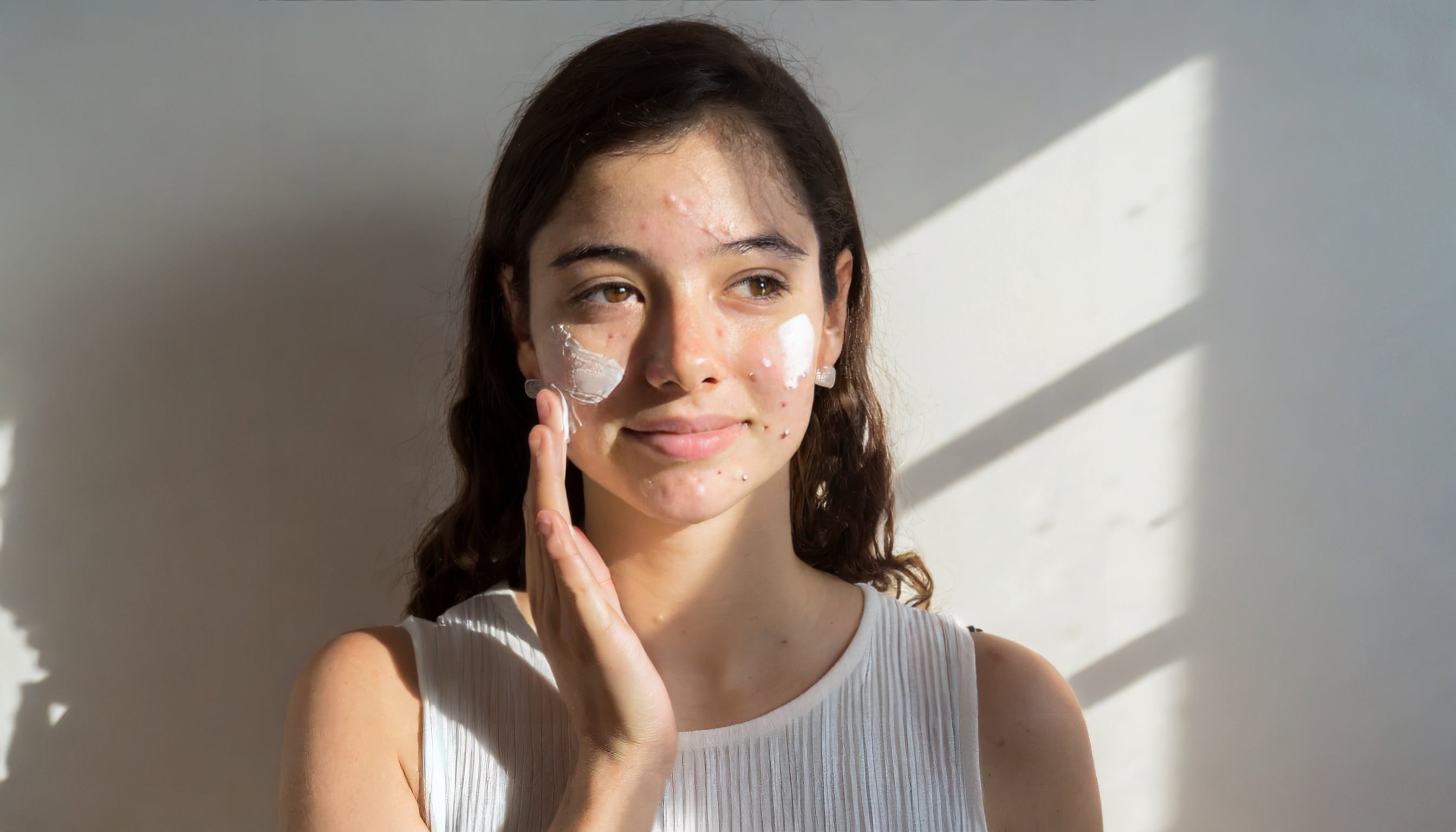 La tiña versicolor, una infección fúngica, provoca manchas blancas en el pecho, la espalda y el rostro, y suele tratarse con medicamentos antimicóticos (Imagen Ilustrativa Infobae)