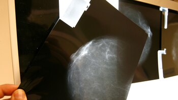 Descifran el mecanismo de una