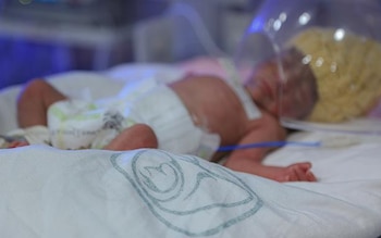 El proyecto incluye la actuación