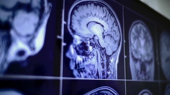 El proceso de implantación mínimamente