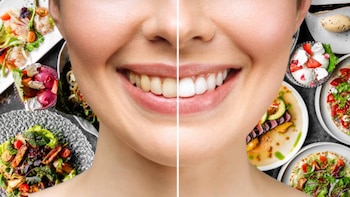 ¿Dientes amarillos? Cuatro alimentos que