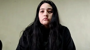 Murió un niño de 3 años tras ser atacado por una perra: el dramático relato de su mamá